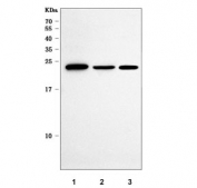 Western blot testing of human 1) K562, 2) Jurkat and 3) HEL cell lysate with POLR3GL antibody. Predicted molecular weight ~25 kDa, commonly observed at 25-32 kDa.