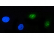 Immunofluorescent staining of FFPE human A549 cells with POLR3GL antibody (green) and DAPI nuclear stain (blue). HIER: steam section in pH6 citrate buffer for 20 min.