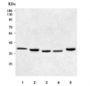 Western blot testing of 1) human ThP-1, 2) human MCF7, 3) rat liver, 4) rat kidney and 5) rat PC-12 cell lysate with NAAA antibody. Predicted molecular weight ~40/36/22 kDa (multiple isoforms).