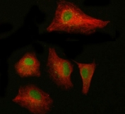 Immunofluorescent staining of FFPE human A549 cells with NAB1 antibody (green) and Beta Tubulin mAb (red). HIER: steam section in pH6 citrate buffer for 20 min.