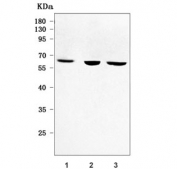 Western blot testing of human 1) HaCaT, 2) A431 and 3) K562 cell lysate with PIGV antibody. Predicted molecular weight ~56 kDa.