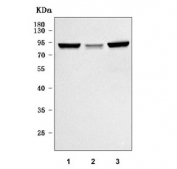 Western blot testing of 1) rat brain, 2) mouse lung and 3) mouse brain tissue lysate with PKCE antibody. Predicted molecular weight ~84 kDa.