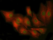 Immunofluorescent staining of FFPE human A549 cells with PKCE antibody (green) and Alpha Tubulin mAb (red). HIER: steam section in pH6 citrate buffer for 20 min.