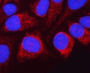 Immunofluorescent staining of FFPE human HeLa cells with HRPAP20 antibody (red) and DAPI nuclear stain (blue). HIER: steam section in pH6 citrate buffer for 20 min.