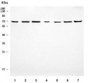 Western blot testing of 1) human SH-SY5Y, 2) human U-87 MG, 3) rat brain, 4) rat liver, 5) rat RH35, 6) mouse brain and 7) mouse Neuro-2a cell lysate with APLP1 antibody. Predicted molecular weight ~72 kDa but may be observed at higher molecular weights due to glycosylation.