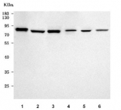 Western blot testing of 1) human HepG2, 2) human U-251, 3) human HeLa, 4) rat kidney, 5) mouse kidney and 6) mouse thymus tissue lysate with OSBPL10 antibody. Predicted molecular weight ~84 kDa.
