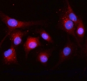 Immunofluorescent staining of FFPE human A549 cells with OSBPL10 antibody (red) and DAPI nuclear stain (blue). HIER: steam section in pH6 citrate buffer for 20 min.
