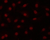 Immunofluorescent staining of FFPE human A549 cells with SNEV antibody (red). HIER: steam section in pH6 citrate buffer for 20 min.