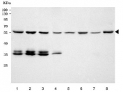 Western blot testing of 1) human HeLa, 2) human 293T, 3) human A549, 4) human Caco-2, 5) rat brain, 6) rat C6, 7) mouse brain and 8) mouse NIH 3T3 cell lysate with PRP31 antibody. Predicted molecular weight ~55 kDa.