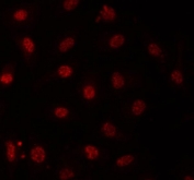 Immunofluorescent staining of FFPE human A549 cells with PRP31 antibody (red). HIER: steam section in pH6 citrate buffer for 20 min.
