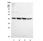 Western blot testing of human 1) Caco-2, 2) MCF7, 3) RT4 and 4) HaCaT cell lysate with PRSS22 antibody. Predicted molecular weight ~33 kDa but may be observed at higher molecular weights due to glycosylation.