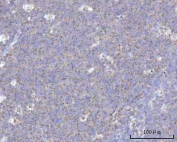IHC staining of FFPE human tonsil tissue with NDUFB7 antibody. HIER: boil tissue sections in pH8 EDTA for 20 min and allow to cool before testing.