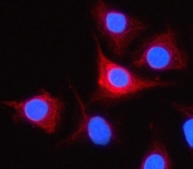 Immunofluorescent staining of FFPE human A549 cells with TESSP-4 antibody (red) and DAPI nuclear stain (blue). HIER: steam section in pH6 citrate buffer for 20 min.