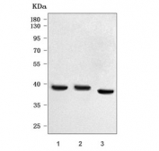 Western blot testing of human 1) Caco-2, 2) MCF7 and 3) placental tissue lysate with Prostasin antibody. Predicted molecular weight ~36 kDa.