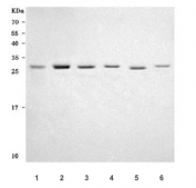 Western blot testing of 1) human Caco-2, 2) human HeLa, 3) human A549, 4) human K562, 5) rat brain and 6) mouse brain tissue lysate with PRTFDC1 antibody. Predicted molecular weight ~26 kDa.