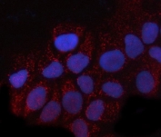 Immunofluorescent staining of FFPE human A431 cells with GNB1 antibody (red) and DAPI nuclear stain (blue). HIER: steam section in pH6 citrate buffer for 20 min.