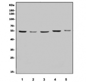 Western blot testing of human 1) K562, 2) HeLa, 3) HepG2, 4) PC-3 and 5) Caco-2 cell lysate with Eukaryotic translation initiation factor 5 antibody. Predicted molecular weight ~49 kDa.