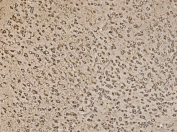 IHC staining of FFPE mouse brain tissue with Eukaryotic translation initiation factor 5 antibody. HIER: boil tissue sections in pH8 EDTA for 20 min and allow to cool before testing.