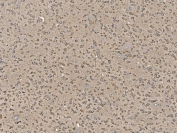 IHC staining of FFPE mouse brain tissue with Eukaryotic translation initiation factor 5 antibody. HIER: boil tissue sections in pH8 EDTA for 20 min and allow to cool before testing.