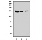 Western blot testing of 1) human K562, 2) rat brain and 3) mouse brain tissue lysate with KIF5A antibody. Predicted molecular weight ~117 kDa.