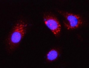 Immunofluorescent staining of FFPE human PC-3 cells with PGP antibody (red) and DAPI nuclear stain (blue). HIER: steam section in pH6 citrate buffer for 20 min.