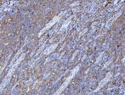 IHC staining of FFPE human tonsil tissue with PGP antibody. HIER: boil tissue sections in pH8 EDTA for 20 min and allow to cool before testing.