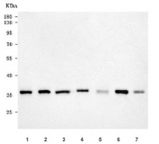 Western blot testing of 1) human HeLa, 2) human MCF7, 3) human 293T, 4) rat brain, 5) rat lung, 6) mouse brain and 7) mouse lung tissue lysate with PGP antibody. Predicted molecular weight ~34 kDa.