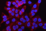 Immunofluorescent staining of FFPE human U-2 OS cells with RAB39A/B antibody (red) and DAPI nuclear stain (blue). HIER: steam section in pH6 citrate buffer for 20 min.