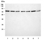 Western blot testing of 1) human HeLa, 2) human MCF7, 3) human HepG2, 4) rat brain, 5) rat PC-12, 6) mouse brain and 7) mouse Neuro-2a cell lysate with PPP2R5D antibody. Predicted molecular weight ~58 kDa, ~66 kDa and ~70 kDa (multiple isoforms).