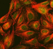 Immunofluorescent staining of FFPE human U-2 OS cells with PPP2R5D antibody (green) and Alpha Tubulin mAb (red). HIER: steam section in pH6 citrate buffer for 20 min.