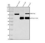 Immunoprecipitation of PPP2R5D protein from 500ug of human HepG2 whole cell lysate with 2ug of PPP2R5D antibody.