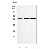 Western blot testing of 1) human HeLa, 2) human U-87 MG and 3) rat C6 cell lysate with PPP3CA antibody. Predicted molecular weight: 51-59 kDa, ~32 kDa (multiple isoforms).