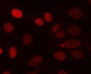 Immunofluorescent staining of FFPE human U-2 OS cells with PPP3CA antibody (red). HIER: steam section in pH6 citrate buffer for 20 min.