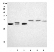 Western blot testing of 1) human K562, 2) human MCF7, 3) human A549, 4) rat liver, 5) rat RH35 and 6) mouse HEPA1-6 cell lysate with Biliverdin reductase B antibody. Predicted molecular weight ~22 kDa, commonly observed at 22-27 kDa.