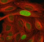 Immunofluorescent staining of FFPE human HeLa cells with CDKN1A antibody (green) and Tubulin beta mAb (red). HIER: steam section in pH6 citrate buffer for 20 min.