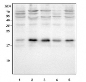 Western blot testing of human 1) HeLa, 2) HepG2, 3) MCF7, 4) U-2 OS and 5) SiHa cell lysate with CDKN1A antibody. Predicted molecular weight ~18 kDa, commonly observed at ~21 kDa.