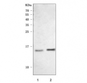 Western blot testing of human 1) SH-SY5Y and 2) MOLT4 cell lysate with CRABP1 antibody. Predicted molecular weight ~16 kDa.