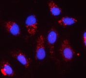 Immunofluorescent staining of FFPE human A549 cells with CYC1 antibody (red) and DAPI nuclear stain (blue). HIER: steam section in pH6 citrate buffer for 20 min.