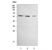 Western blot testing of human 1) Jurkat, 2) HeLa and 3) A431 cell lysate with E2F1 antibody. Expected molecular weight: 48-60 kDa.