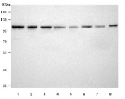 Western blot testing of 1) human A431, 2) human HaCaT, 3) rat brain, 4) rat stomach, 5) rat lung, 6) mouse brain, 7) mouse stomach and 8) mouse lung tissue lysate with Ephrin Receptor B3 antibody. Predicted molecular weight ~110 kDa but may be observed at higher molecular weights due to glycosylation. 