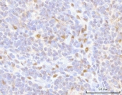 IHC staining of FFPE human tonsil tissue with HOXD10 antibody. HIER: boil tissue sections in pH8 EDTA for 20 min and allow to cool before testing.