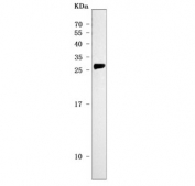 Western blot testing of human HCCT cell lysate with Mannose-binding protein C antibody. Predicted molecular weight ~26 kDa.