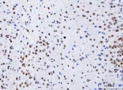 IHC staining of FFPE mouse cerebral cortex tissue with CBP80 antibody. HIER: boil tissue sections in pH8 EDTA for 20 min and allow to cool before testing.