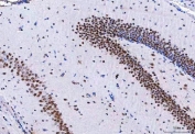 IHC staining of FFPE mouse hippocampus tissue with CBP80 antibody. HIER: boil tissue sections in pH8 EDTA for 20 min and allow to cool before testing.