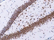 IHC staining of FFPE rat hippocampus tissue with CBP80 antibody. HIER: boil tissue sections in pH8 EDTA for 20 min and allow to cool before testing.