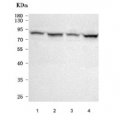 Western blot testing of human 1) HeLa, 2) Jurkat, 3) HepG2 and 4) MCF7 cell lysate with CBP80 antibody. Predicted molecular weight ~92 kDa.