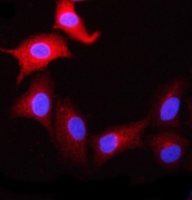Immunofluorescent staining of FFPE human A549 cells with CBP80 antibody (red) and DAPI nuclear stain (blue). HIER: steam section in pH6 citrate buffer for 20 min.