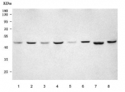 Western blot testing of 1) human CCRF-CEM, 2) human MOLT4, 3) human SK-O-V3, 4) human MCF7, 5) rat kidney, 6) rat PC-12, 7) mouse kidney and 8) mouse NIH 3T3 cell lysate with PSMC5 antibody. Predicted molecular weight ~46 kDa.