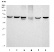 Western blot testing of 1) human HeLa, 2) human A549, 3) human U-251, 4) human PC-3, 5) rat brain and 6) mouse brain tissue lysate with NFIX antibody. Predicted molecular weight ~55 kDa.