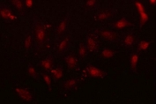 Immunofluorescent staining of FFPE human A549 cells with NFIX antibody (red) and DAPI nuclear stain (blue). HIER: steam section in pH6 citrate buffer for 20 min.